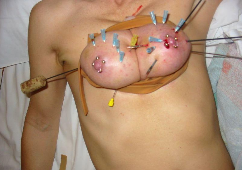 【閲覧注意】乳首やクリトリスを針で貫通させられた女性の反応が怖すぎてワロエナイ・・・・・・31枚目